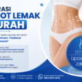 operasi sedot lemak murah