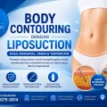 Dokter menjelaskan apakah sedot lemak bikin buncit lagi di Liposuction Jakarta.